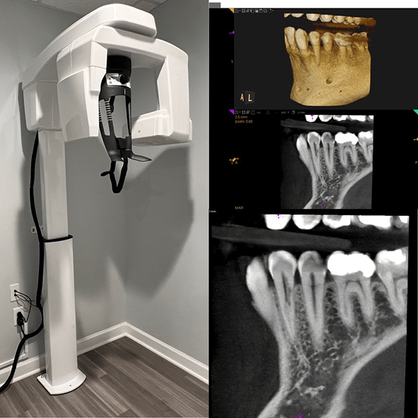 Cone Beam with Images